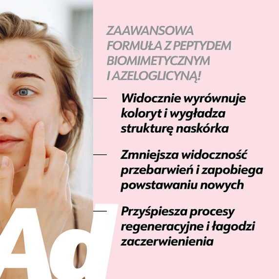 Serum na przebarwienia potrądzikowe