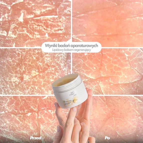 Lipidowy balsam regenerujący
